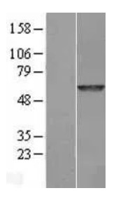 GALNS Human Over-expression Lysate