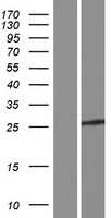 GSTM1 Human Over-expression Lysate