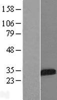 IGFBP5 Human Over-expression Lysate