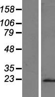 C8 (C8G) Human Over-expression Lysate