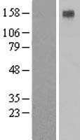 ATP4A Human Over-expression Lysate