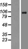 NMDAR1 (GRIN1) Human Over-expression Lysate