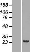 GSTM4 Human Over-expression Lysate