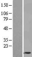 UBASH3A Human Over-expression Lysate