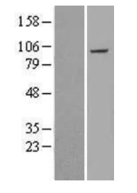 Plakophilin 2 (PKP2) Human Over-expression Lysate