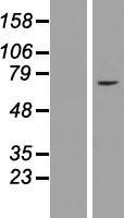 ZNF182 Human Over-expression Lysate