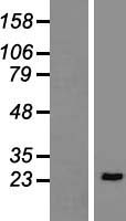 LAT Human Over-expression Lysate