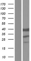 ETFB Human Over-expression Lysate