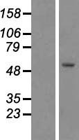 KATNAL1 Human Over-expression Lysate