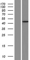 MOCS1 Human Over-expression Lysate