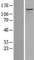 ADAR1 (ADAR) Human Over-expression Lysate