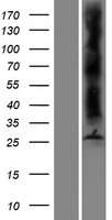 Aquaporin 8 (AQP8) Human Over-expression Lysate