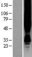 G protein coupled receptor 30 (GPER1) Human Over-expression Lysate