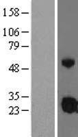 IGFBP4 Human Over-expression Lysate