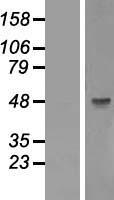 GSK3 beta (GSK3B) Human Over-expression Lysate