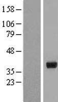 HSD17B2 Human Over-expression Lysate