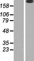 Laminin beta 2 (LAMB2) Human Over-expression Lysate