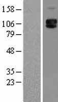 CD62P (SELP) Human Over-expression Lysate