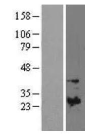 TIMP1 Human Over-expression Lysate