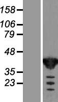 GFUS Human Over-expression Lysate