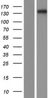 Plakophilin 4 (PKP4) Human Over-expression Lysate