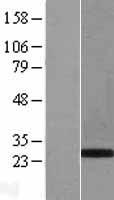 PHOX2B Human Over-expression Lysate
