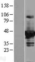 DOK2 Human Over-expression Lysate