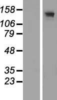 ADCY3 Human Over-expression Lysate