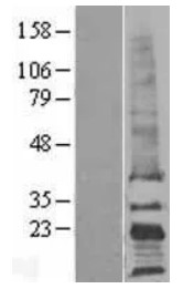 TAPA1 (CD81) Human Over-expression Lysate