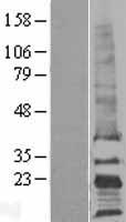 TAPA1 (CD81) Human Over-expression Lysate