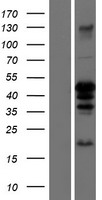 CEBP Alpha (CEBPA) Human Over-expression Lysate