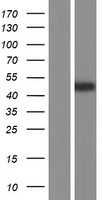 Estrogen Related Receptor alpha (ESRRA) Human Over-expression Lysate