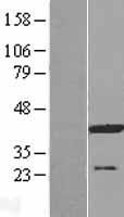 ATP6V0D1 Human Over-expression Lysate