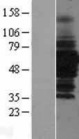 HDAC1 Human Over-expression Lysate