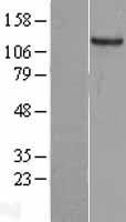 GUCY2C Human Over-expression Lysate