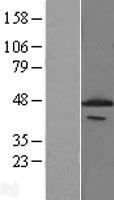PCYT1A Human Over-expression Lysate
