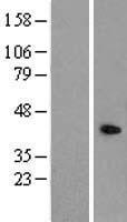 ENDOGL1 (EXOG) Human Over-expression Lysate