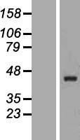 Constitutive androstane receptor (NR1I3) Human Over-expression Lysate