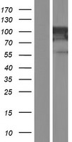 MVP Human Over-expression Lysate
