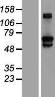 GFPT2 Human Over-expression Lysate