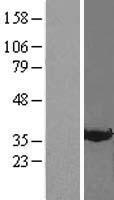 Annexin A3 (ANXA3) Human Over-expression Lysate