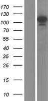 SART1 Human Over-expression Lysate