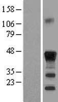 CEBP Beta (CEBPB) Human Over-expression Lysate