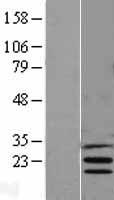 INSIG1 Human Over-expression Lysate