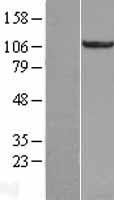 RBM10 Human Over-expression Lysate
