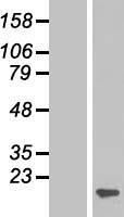 p16 ARC (ARPC5) Human Over-expression Lysate