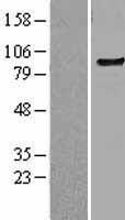 TLR6 Human Over-expression Lysate