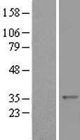 AMPK beta 1 (PRKAB1) Human Over-expression Lysate