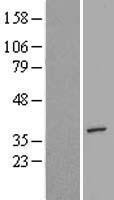 AIMP2 Human Over-expression Lysate