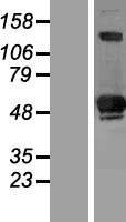 SIVA (SIVA1) Human Over-expression Lysate